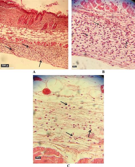 Histopathology of hypodermis. Histopathology analysis showed mild ...