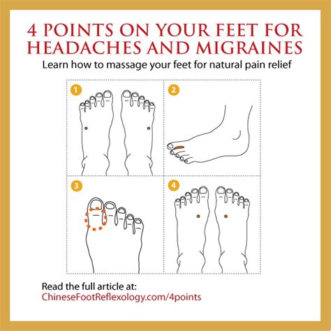 Tension Migraine Pressure Points at Michael Wilson blog