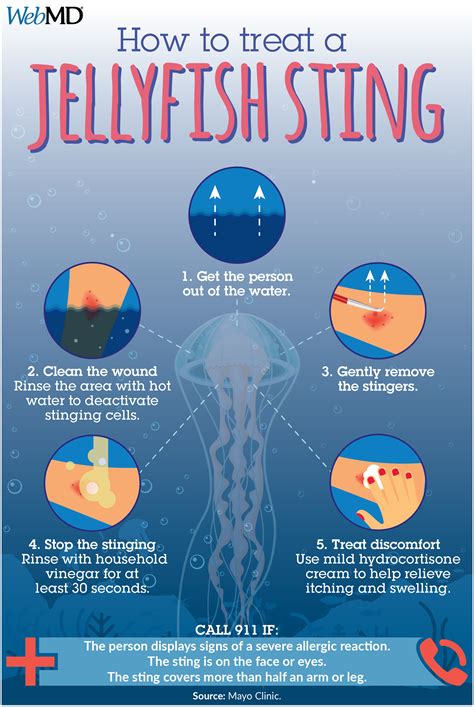 Jellyfish Stings Treatment | Jellyfish sting, Jellyfish, Jellyfish facts