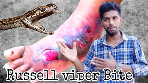 आखिर क्यूं है दुनिया का सबसे खतरनाक सांप?/Russell Viper snake bite ...