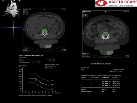 Aarthi scan's