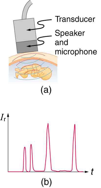 Ultrasound | Physics