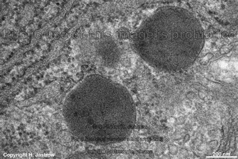 Lysosomes Dr.Jastrow's electron microscopic atlas