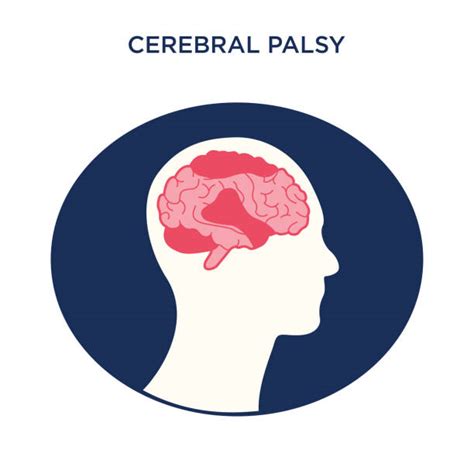 Cerebral Palsy Brain