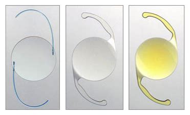 Piggyback IOL Intraocular Lens Power Calculations Primary Polypseudophakia | East Valley ...