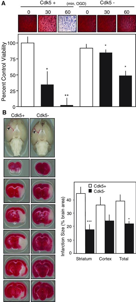 Cdk5 CKO is neuroprotective against ischemia and stroke. A, TTC... | Download Scientific Diagram