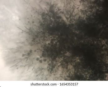 Trichoderma Viridae Mycelium Microscope View Stock Photo 1654353157 ...