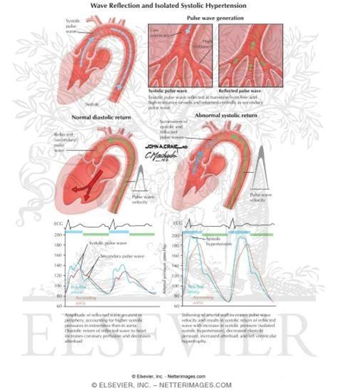 Wave Reflection and Isolated Systolic Hypertension