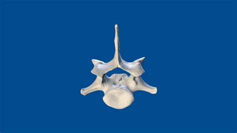3D Dog Bone Project: C7 vertebra - Download Free 3D model by nzfauna ...