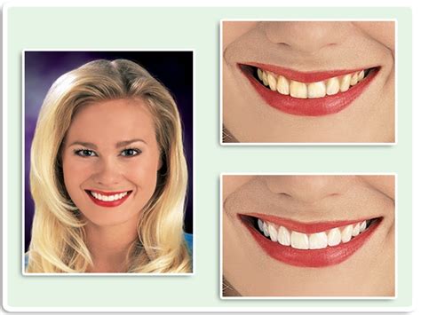 Dallas Cosmetic Dentistry - Dental News Network