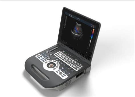 4d Ultrasound Machine Portable Ultrasound Scanner With 120G Capacity 4800 Frames Cine Loop