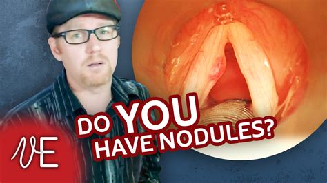 Nodules and Singers? Learn about the symptoms and treatment.