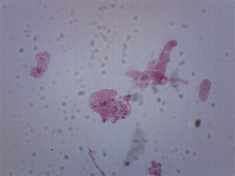 Amoeba Proteus, Whole Mount - Prepared Microscope Slide - 75x25mm — Eisco Labs