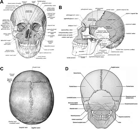 Cranial suture headache: An extracranial head pain syndrome originating ...