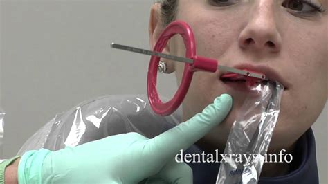 Premolar bitewing positioning tips for dental x-rays - YouTube