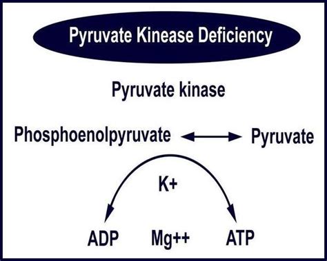 Pyruvate Kinase Deficiency | Ask Hematologist | Understand Hematology