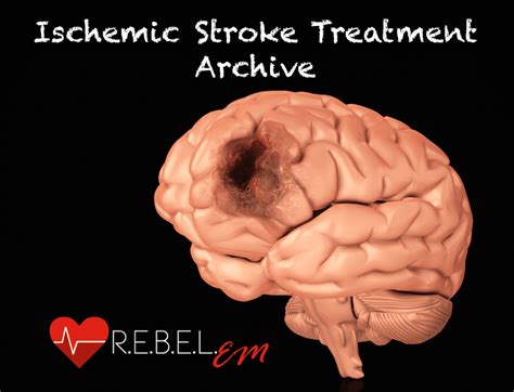 Ischemic Stroke Treatment Archive - REBEL EM - Emergency Medicine Blog