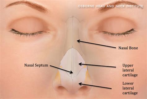 Broken Nose Treatment Los Angeles, CA