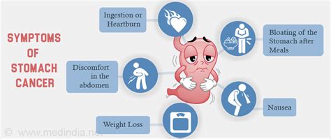 Stomach Cancer | Gastric Cancer