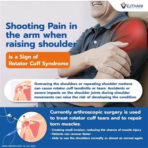 Shooting Pain in the arm when raising shoulder is a sign of Rotator Cuff Syndrome