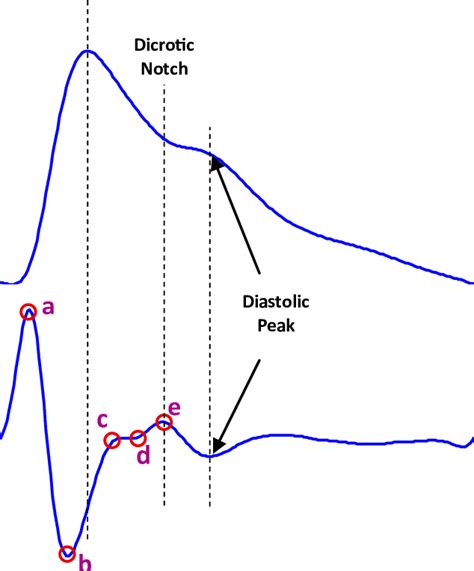 Fingertip photoplethysmogram signal measurement 7. (a) Fingertip... | Download Scientific Diagram