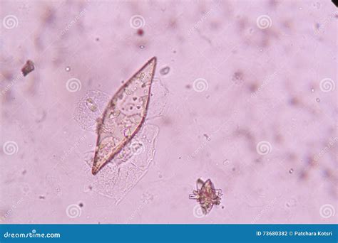 Crystals in urine stock photo. Image of engraved, urine - 73680382