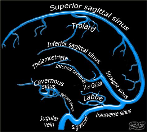 Dural Venous Sinus Anatomy Radiology