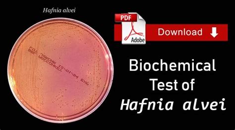 Biochemical Test of Hafnia alvei