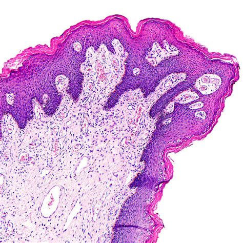 Hematoxylin and Eosin Staining Kit - Teomics