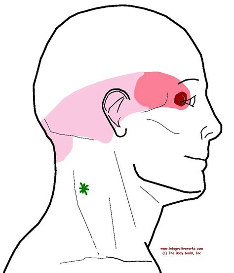 Earache and headache and neck pain information | aboutheadache