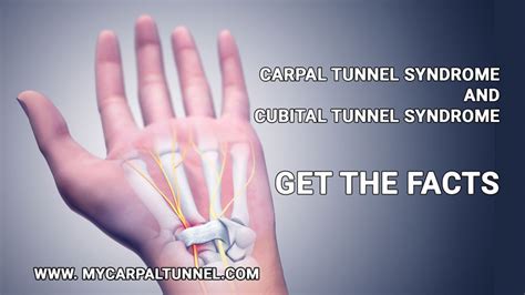 Carpal Tunnel And Cubital Tunnel Surgery At Same Time - mapasgmaes