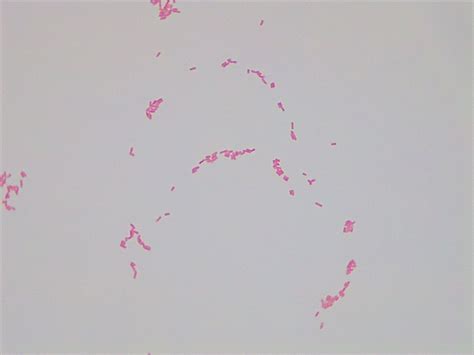 Micrograph Enterobacter aerogenes gram stain 1000X p000175 | OER Commons