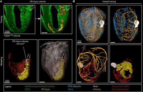 Light Sheet Microscopy: acquire 3D quantitative images of whole organs with cellular resolution ...