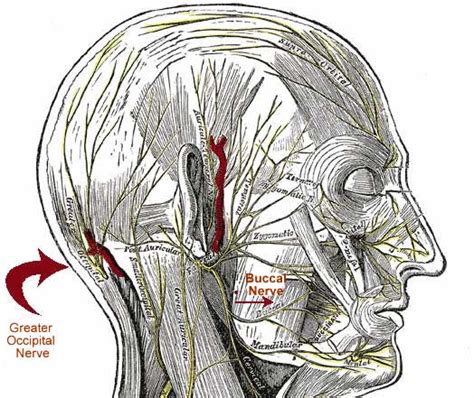 Nerve Pain: Nerve Pain Wisdom Teeth