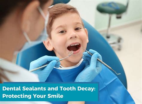 Dental Sealants and Tooth Decay: Protecting Your Smile - Thind