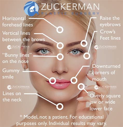 Botox Cosmetic Injections Treatment NYC – Top Ranked Zuckerman Plastic Surgery