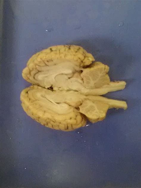 My students did a great job with Central Nervous System anatomy (sheep ...