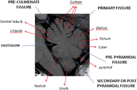 Cerebellum Anatomy Mri