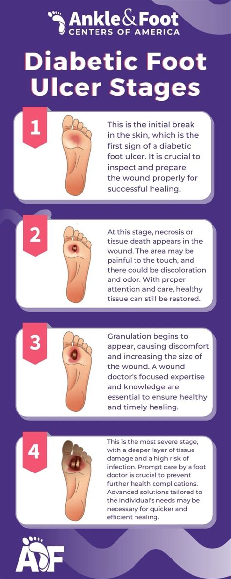 Diabetic Foot Ulcer Stages - Atlanta Wound Doctor Explains