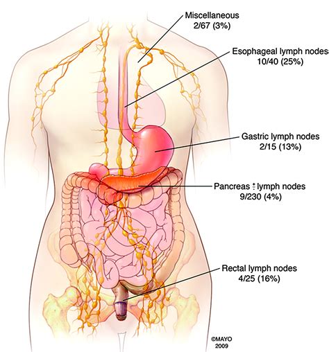 Pancreas: Where Is The Pancreas Located