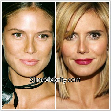 Heidi Klum Plastic Surgery Before and After Photos: Nose Job, Breast Implants, Breast Lifting ...