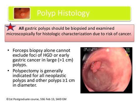 Types Of Gastric Polyps