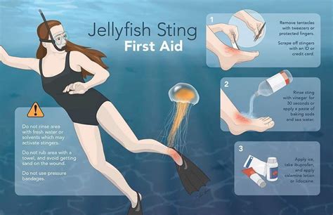 Biliran Island - First Aid for Jellyfish Stings Add these...