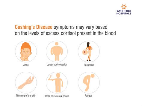 What is Cushing’s Disease? | Yashoda Hospitals | Symptoms & Treatment