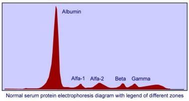 Normal serum protein electrophoresis diagram with