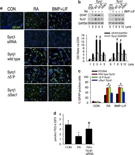 Potential role for phosphatidylinositol metabolism in astrogliogenesis.... | Download Scientific ...