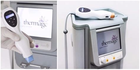 Thermage Review: Cost, Before and Afters, Side Effects, and Results