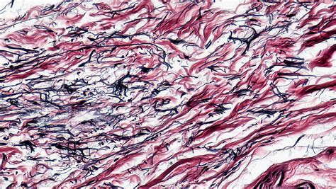 Mammalian Histology: Connective Tissues – Berkshire Community College Bioscience Image Library