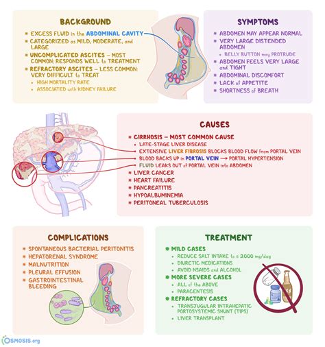 Ascites Is Best Defined as Which of the Following