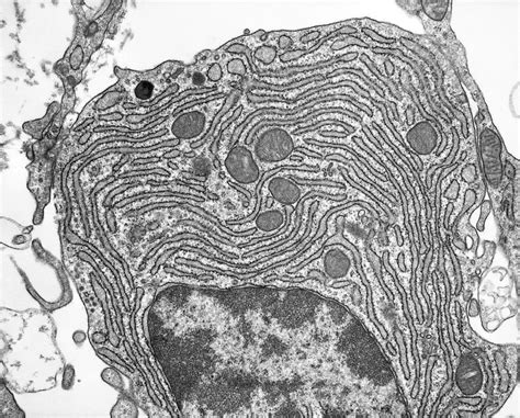 Rough Endoplasmic Reticulum, Tem Photograph by Science Photo Library